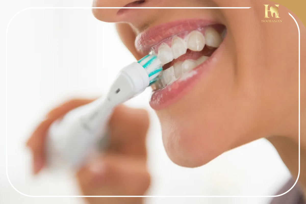 مسواک نرم یا سخت کدام انتخاب بهتری برای دندان های شماست؟ 4 مسواک زدن صحیح