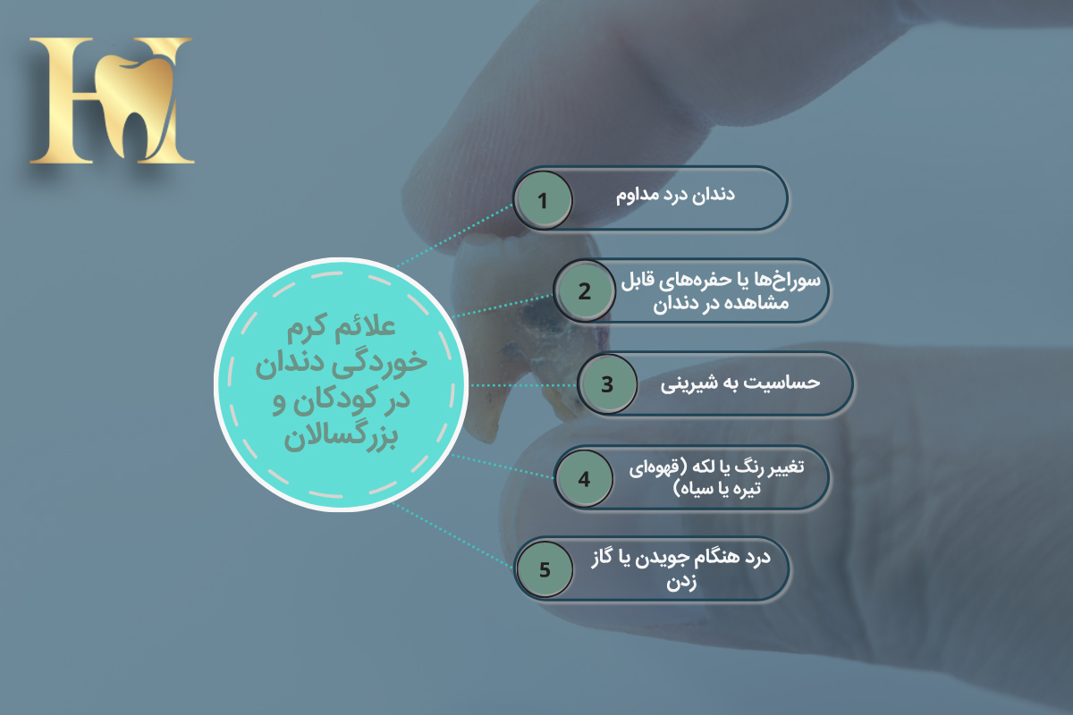 کرم خوردگی دندان: علائم، درمان و پیشگیری 1 علائم اولیه و پیشرفته کرم خوردگی دندان در کودکان و بزرگسالان