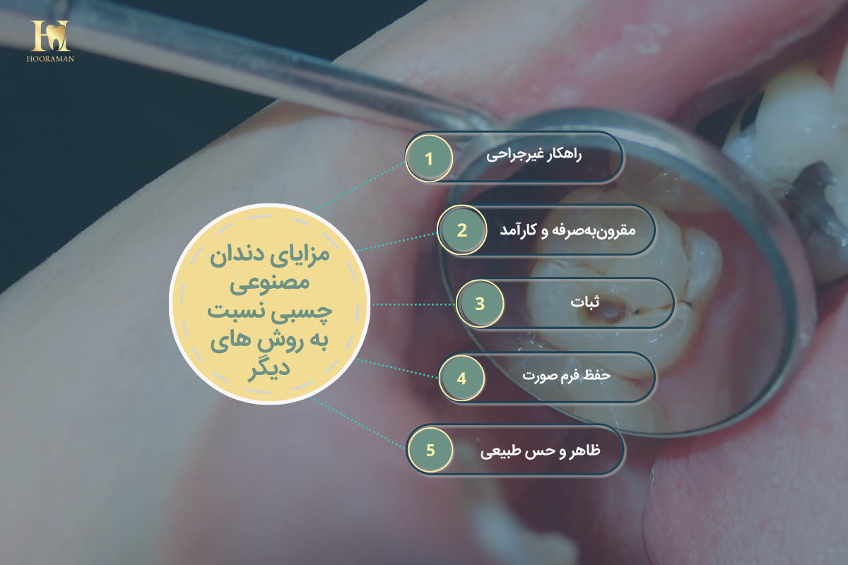 دندان مصنوعی ثابت چسبی: مزایا، معایب، نصب و مقایسه با ایمپلنت 2 مزایای دندان مصنوعی چسبی نسبت به روش های دیگر