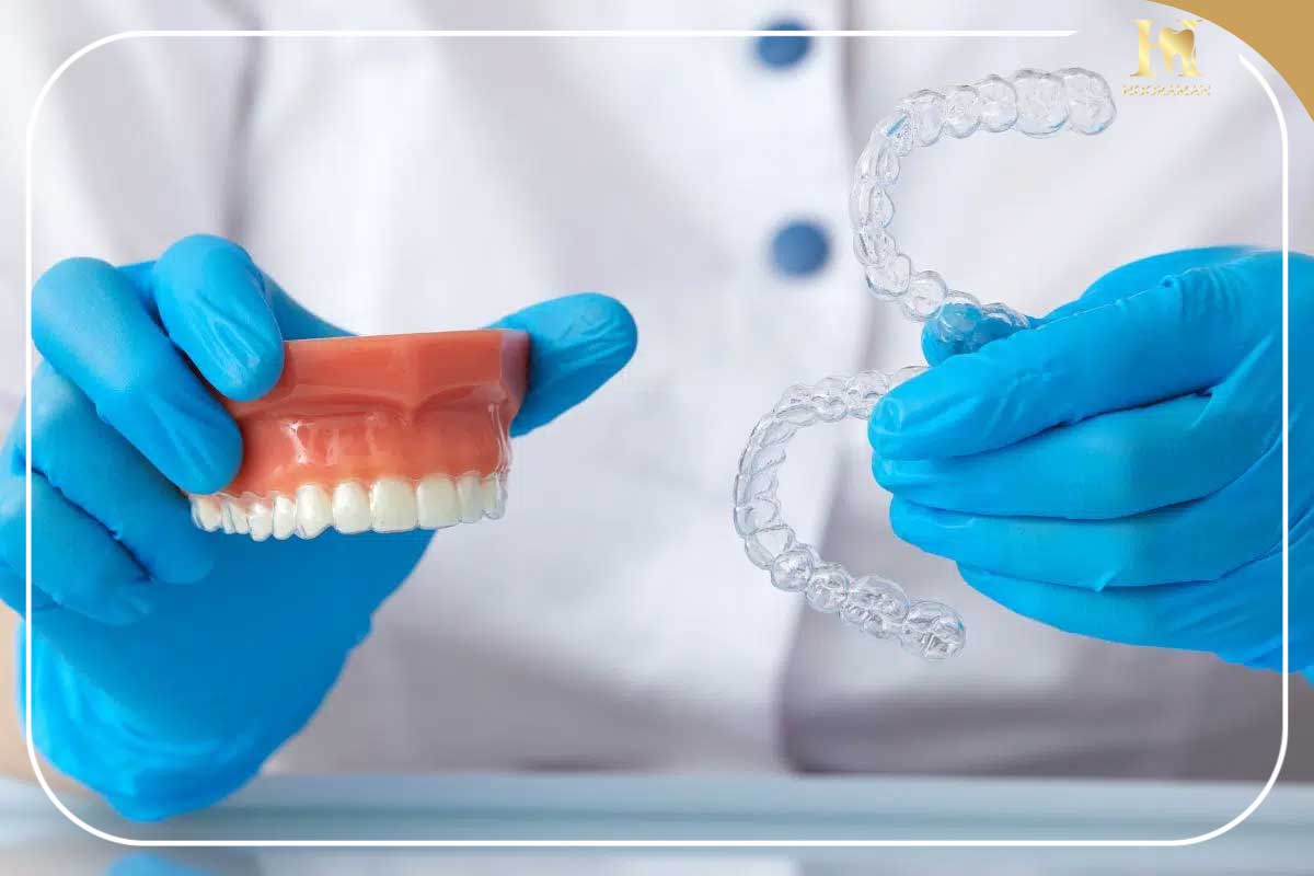 الاینر شفاف چیست؟ راهنمای جامع ارتودنسی نامرئی در کلینیک دندانپزشکی هورامان 5 الاینر دندان