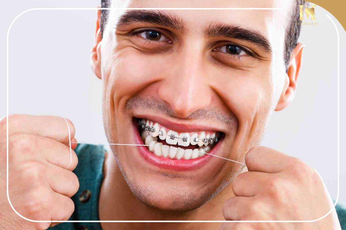 تجربهای نو از دندانپزشکی با بیمه ملت در کلینیک هورامان 2 بیمه ملت