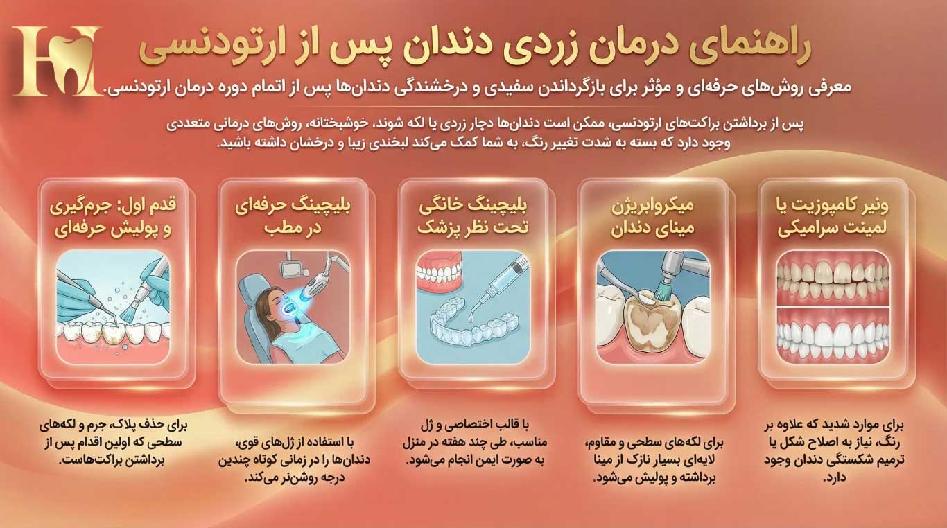 5 عنوان که عین جمله ی زرد شدن دندان بعد از ارتودنسی در آن باشد 4 روشهای درمان زرد شدن دندان بعد از ارتودنسی