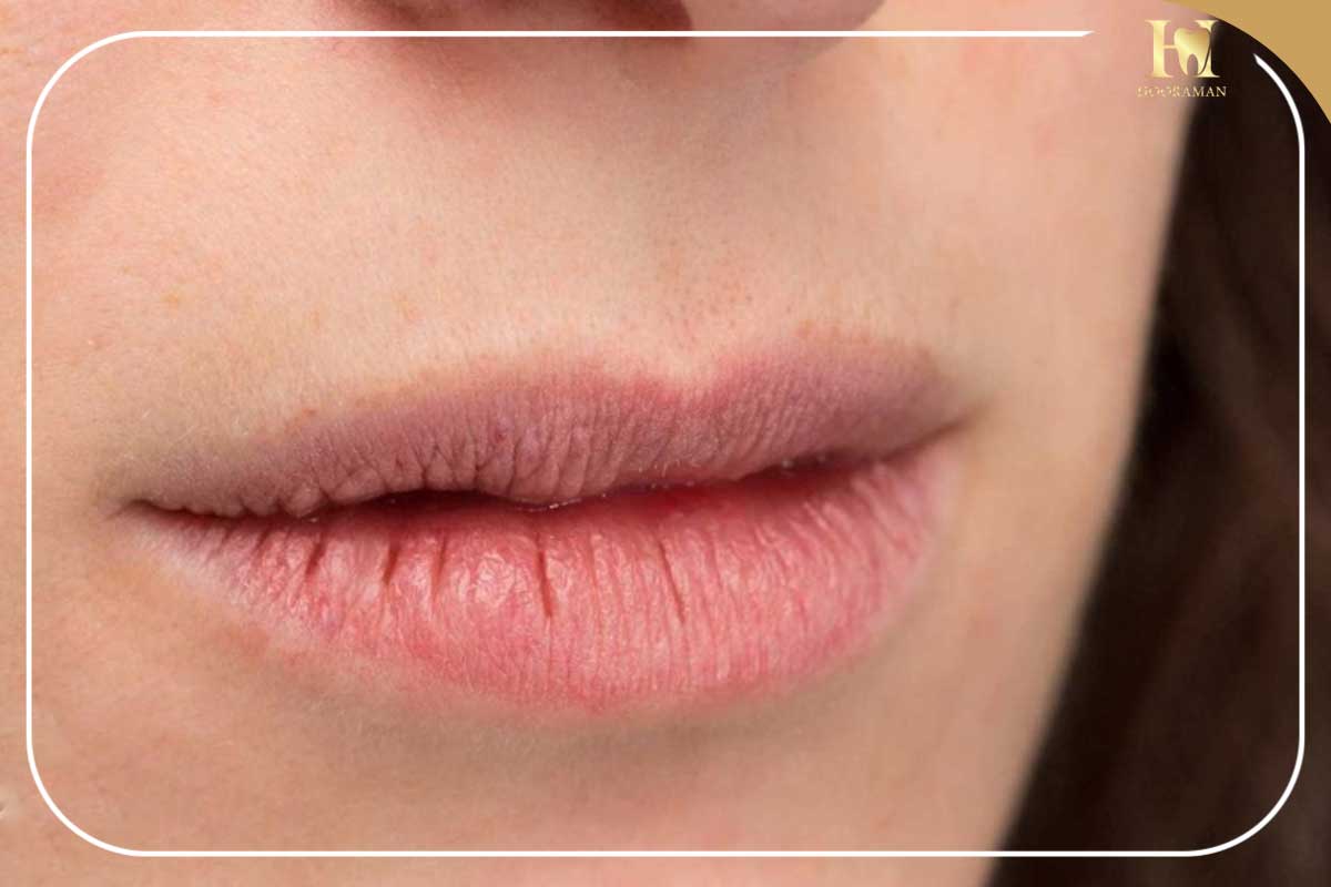 علت خشکی دهان در شب | دلایل علمی، علائم و راههای درمان خشکی دهان هنگام خواب 2 علت خشکی دهان در شب