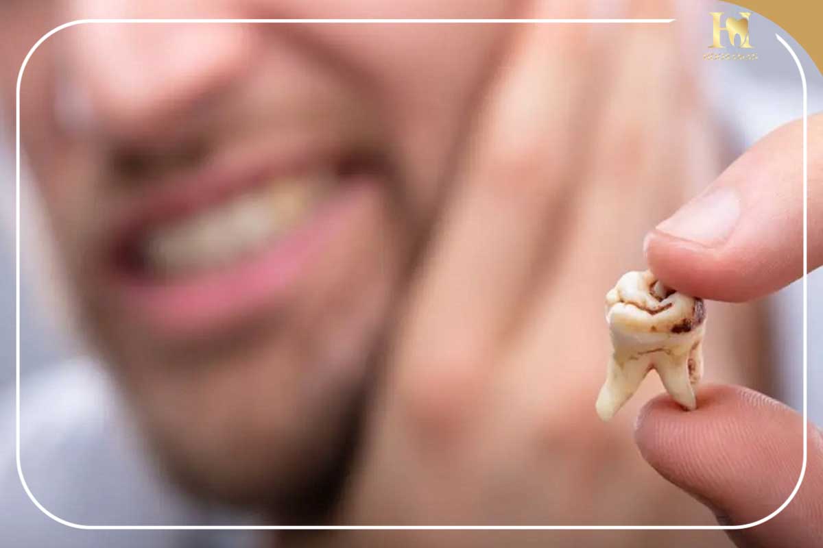 علت خشکی دهان در شب | دلایل علمی، علائم و راههای درمان خشکی دهان هنگام خواب 3 عوارض خشکی دهان در شب