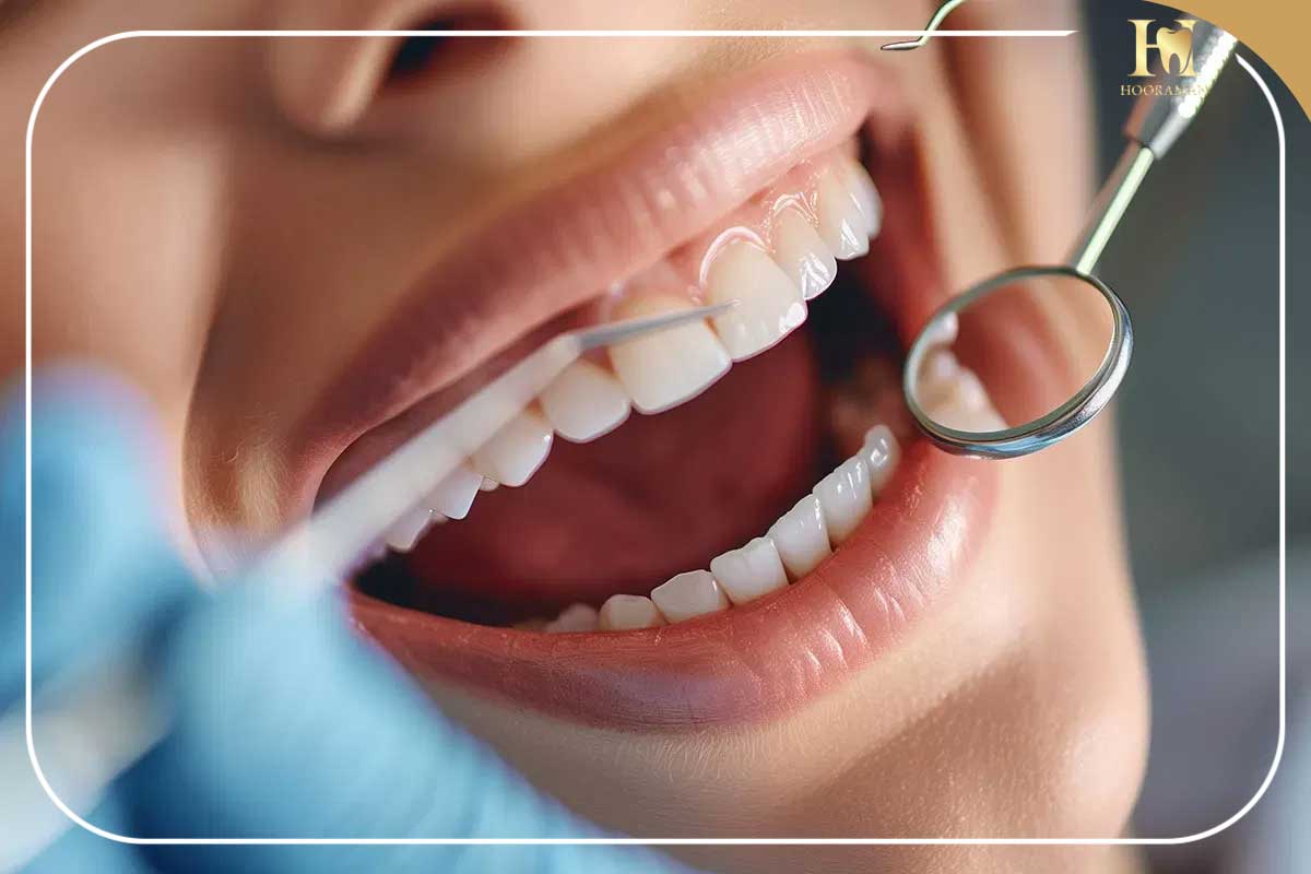 دندانپزشکی بیمه تجارت نو در کلینیک هورامان؛ از مشاوره تا درمان با آرامش و دریافت کامل خسارت 2 Dentistry 1